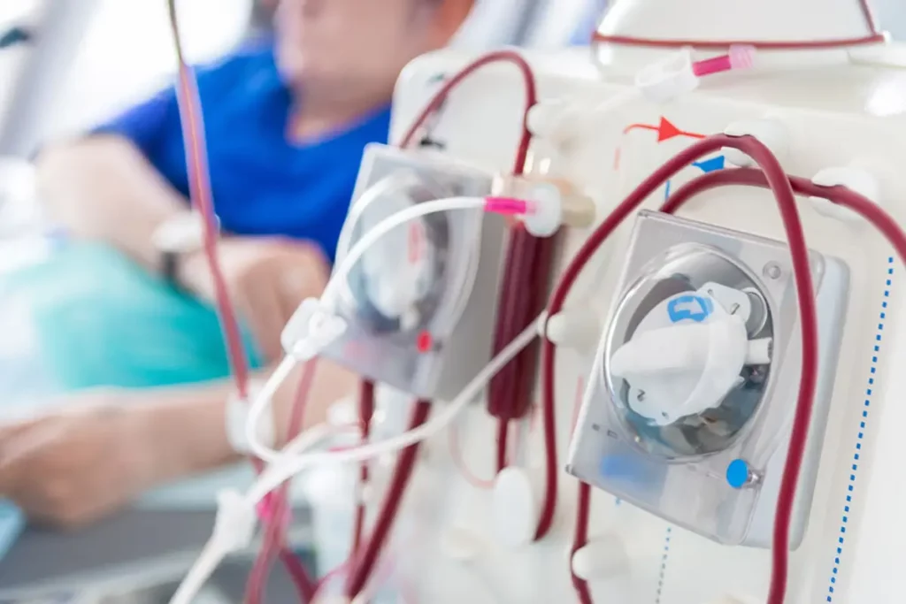 Parcours de soin en dialyse